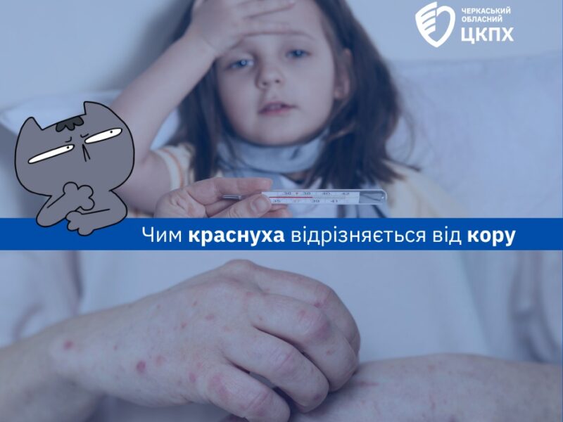 Кір проти краснухи: черкаські фахівці пояснили, як відрізнити схожі інфекції та не пропустити небезпеку