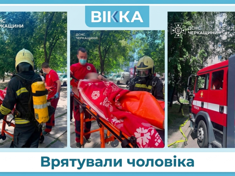 У Черкасах в пожежі врятували чоловіка: з опіками його доставили в лікарню