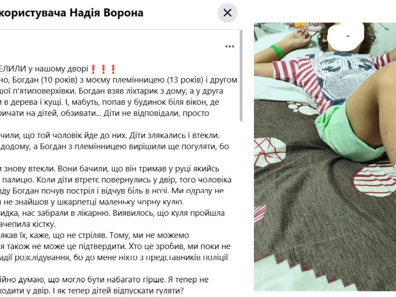 У Черкасах стріляли в дитину: куля прошила ногу наскрізь