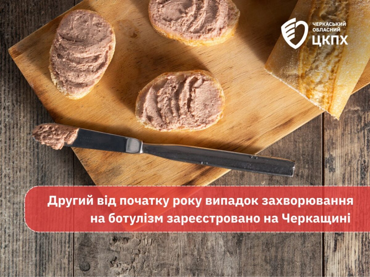 У Черкаському районі жінка захворіла на ботулізм, вона в лікарні